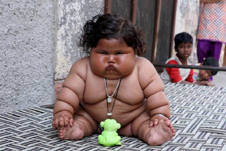 Bayi Usia 8 Bulan ini Punya Bobot 28 Kilogram