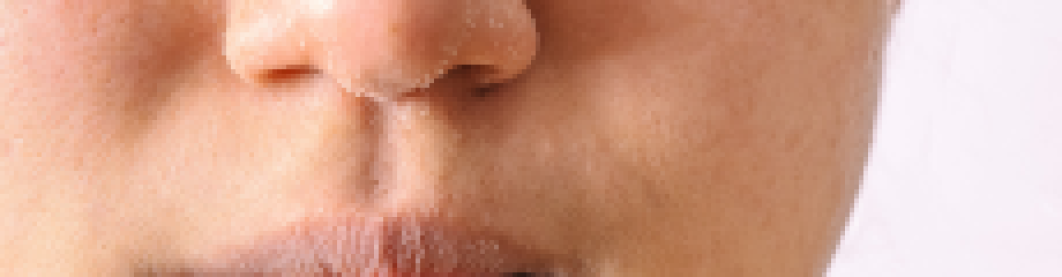 Cara Mengatasi Kulit Kering Dengan Skincare Tepat