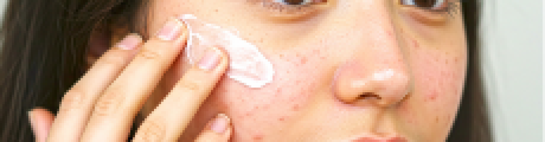 Skincare Yang Harus Dihindari Untuk Kulit Sensitif