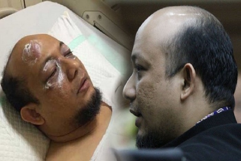 Penyidik Terbaik KPK, Novel Baswedan akan Jalani Operasi Tahap 2