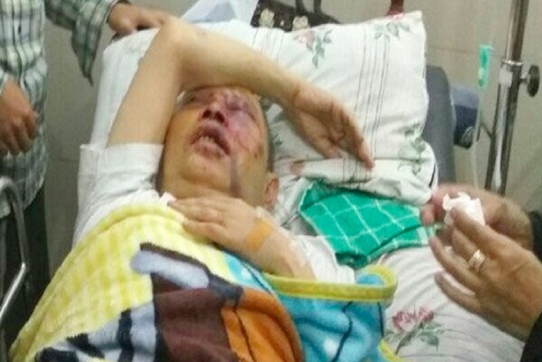 Lagi Khusyuk Zikir, KH Umar Basri Tiba-tiba Dipukuli Orang Tak dikenal di Dalam Masjid
