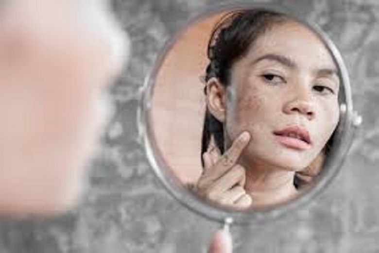 Yuk Kenali 4 Penyebab Penuaan Dini