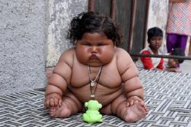 Bayi Usia 8 Bulan ini Punya Bobot 28 Kilogram
