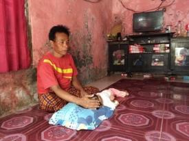 Bocah Gizi Buruk di Kabupaten Serang Ditinggal Kedua Orangtuanya