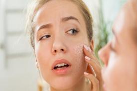 Gambar Artikel Beberapa Faktor Penyebab Kulit Kering dan Sensitif