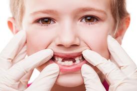 Tips &amp; Trik Termudah Merayu Anak ke Dokter Gigi