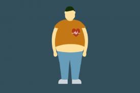 Penelitian Mengklaim Orang Obesitas Plus Pneumonia Bisa Bertahan Hidup lebih Lama